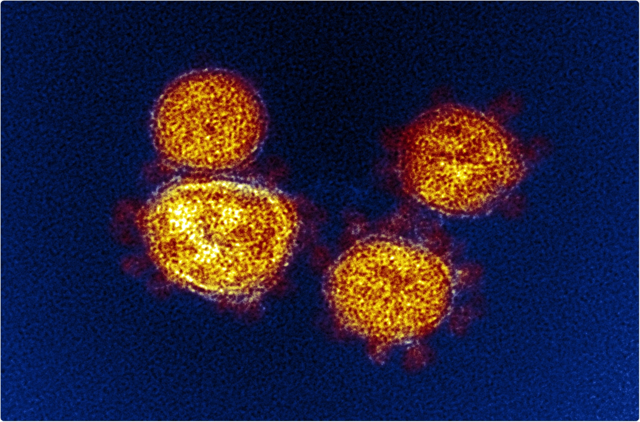 Study: Adverse effects and antibody titers in response to the BNT162b2 mRNA COVID-19 vaccine in a prospective study of healthcare workers. Image Credit: NIAID