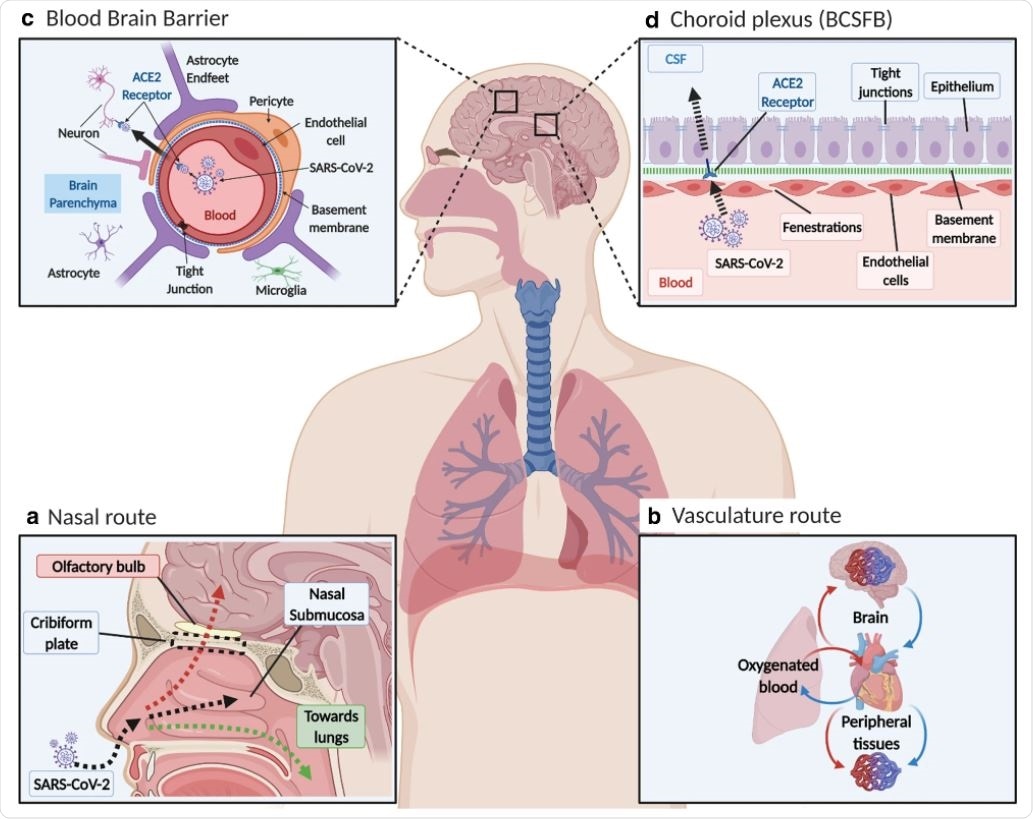 SARS-CoV-2 distribution in blood and possible entry into brain