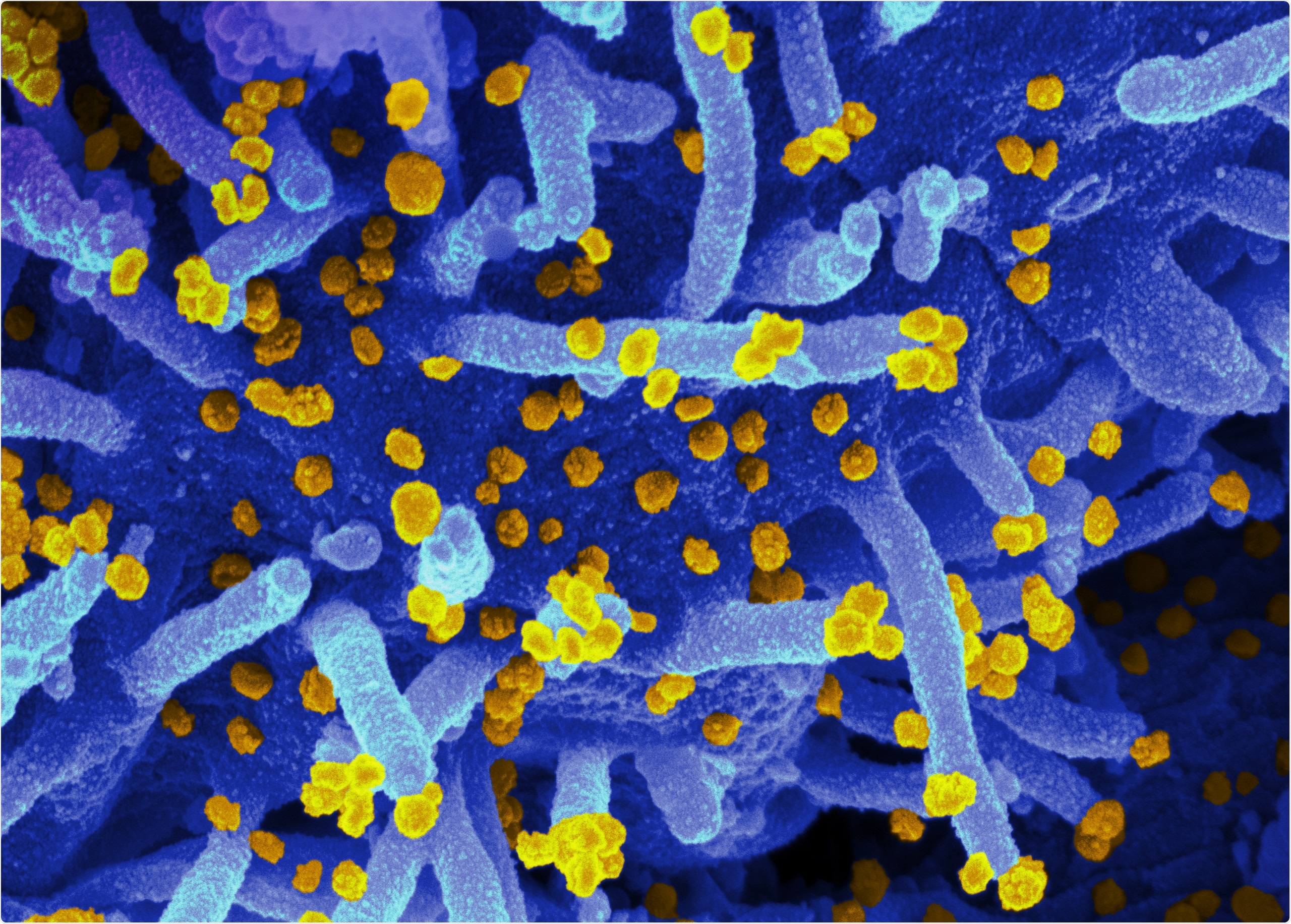 Study: Vaccinated and unvaccinated individuals have similar viral loads in communities with a high prevalence of the SARS-CoV-2 delta variant. Image Credit: NIAID