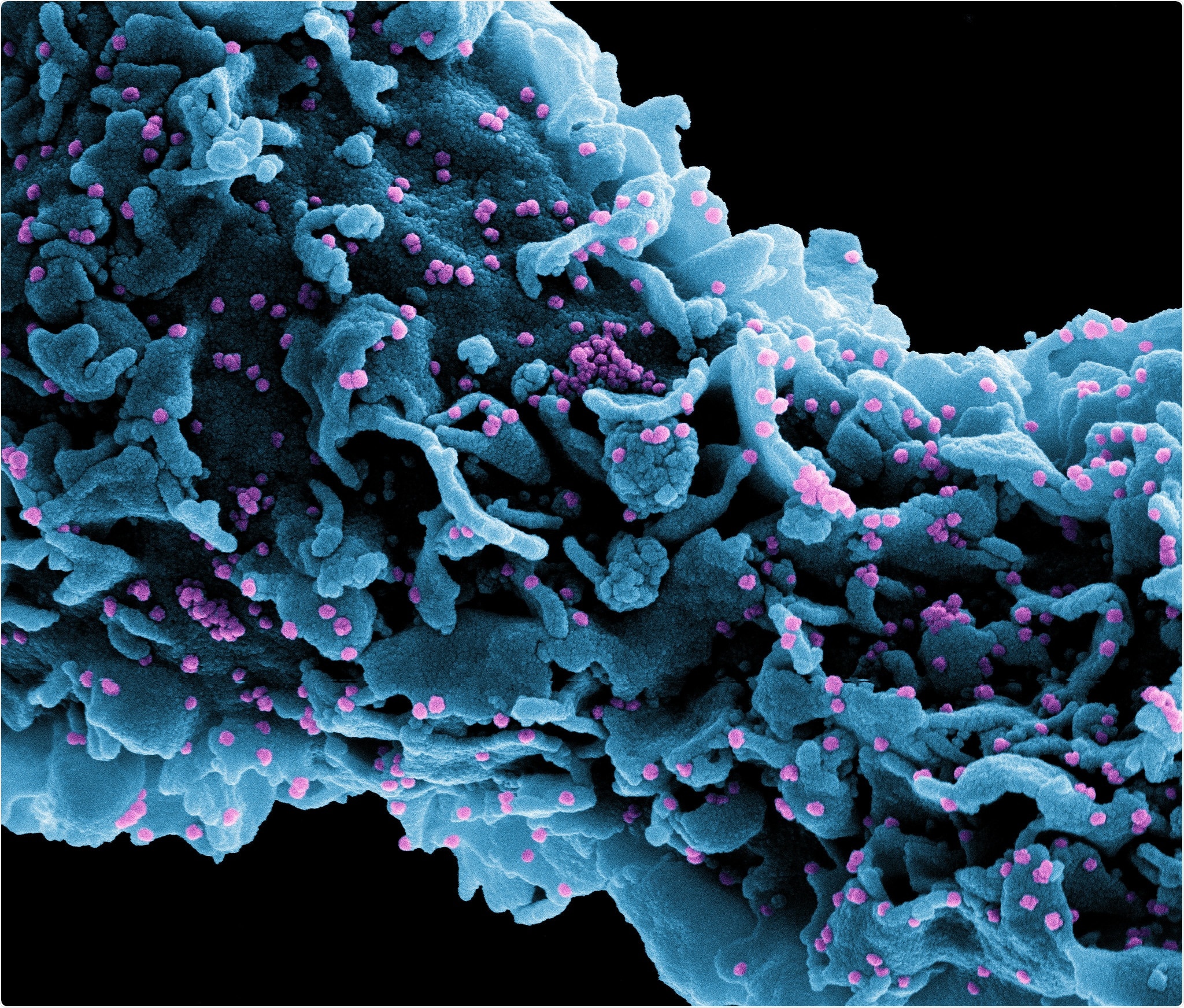 Review: Nanotechnology-based solutions to combat zoonotic viruses with special attention to SARS, MERS, and COVID 19: Detection, protection and medication. Image Credit: NIAID