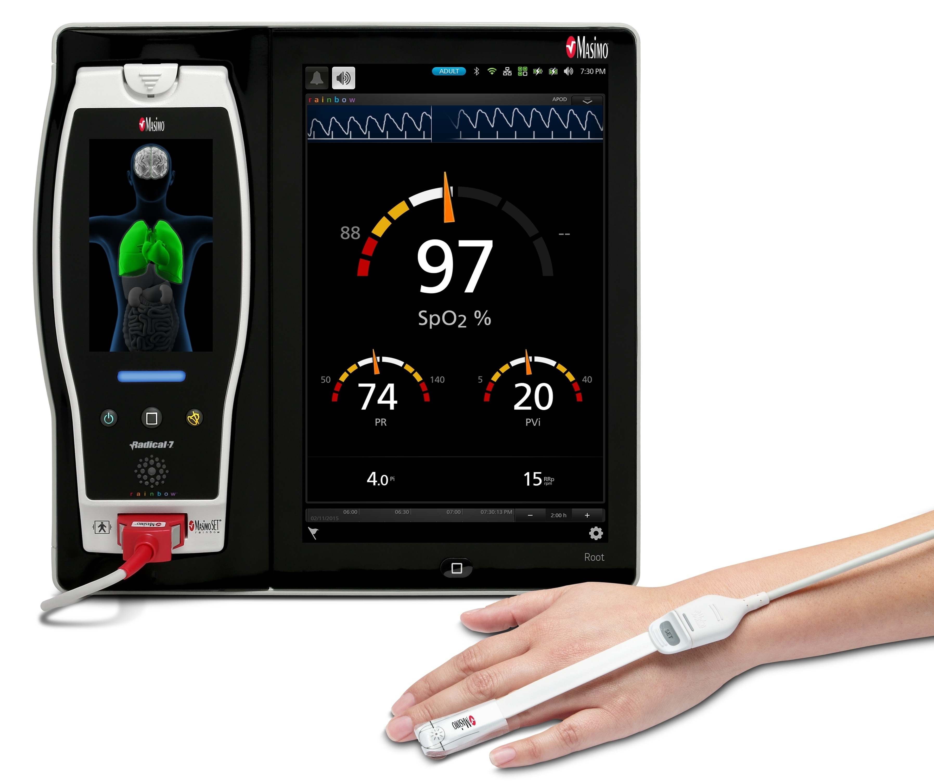 Masimo PVi may provide useful information for monitoring the volume status in spontaneously breathing hemodialysis patients
