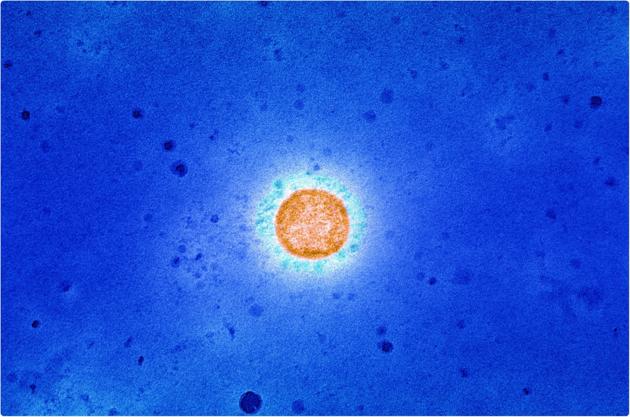 Study: Durability and Cross-Reactivity of Immune Responses Induced by an AS03 Adjuvanted Plant-Based Recombinant Virus-Like Particle Vaccine for COVID-19. Image Credit: NIAID