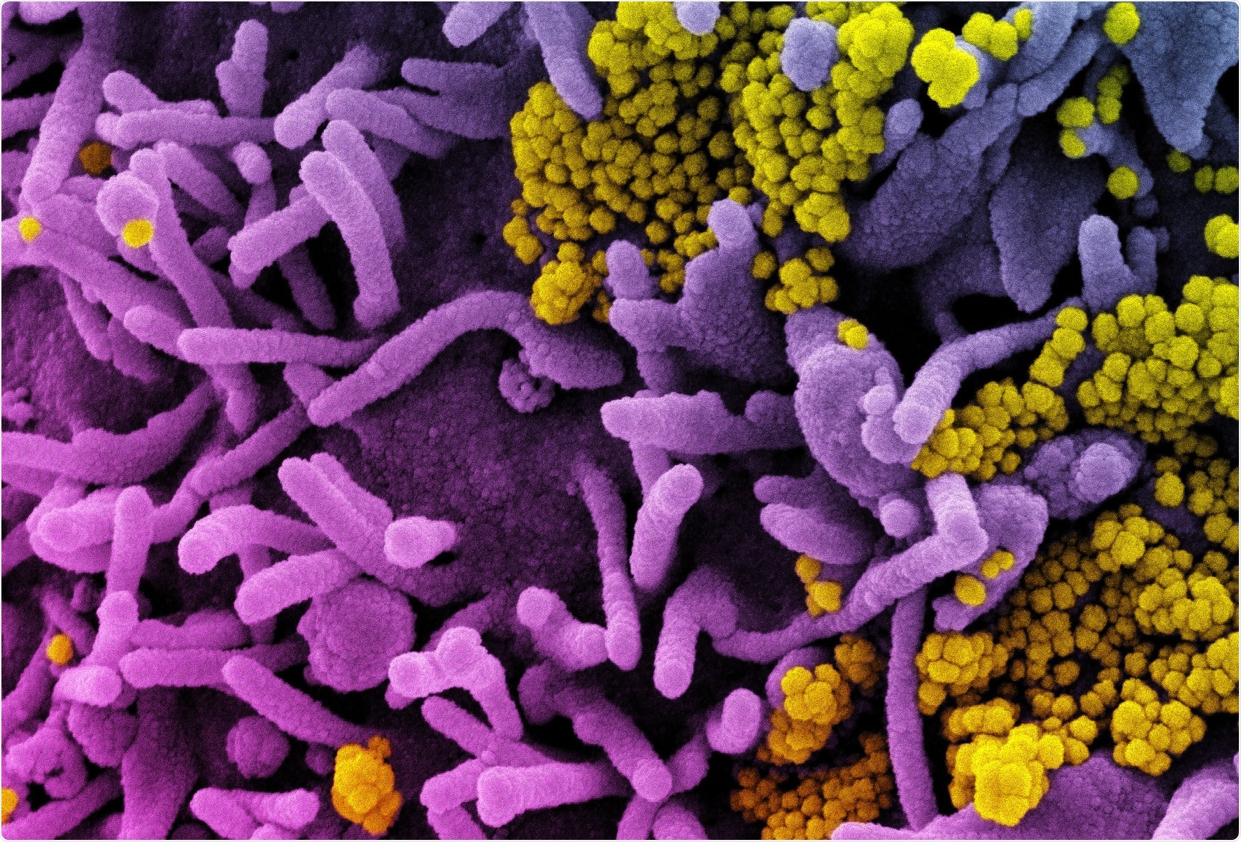 Study: Clinical grade ACE2 as a universal agent to block SARS-CoV-2 variants. Image Credit: NIAID