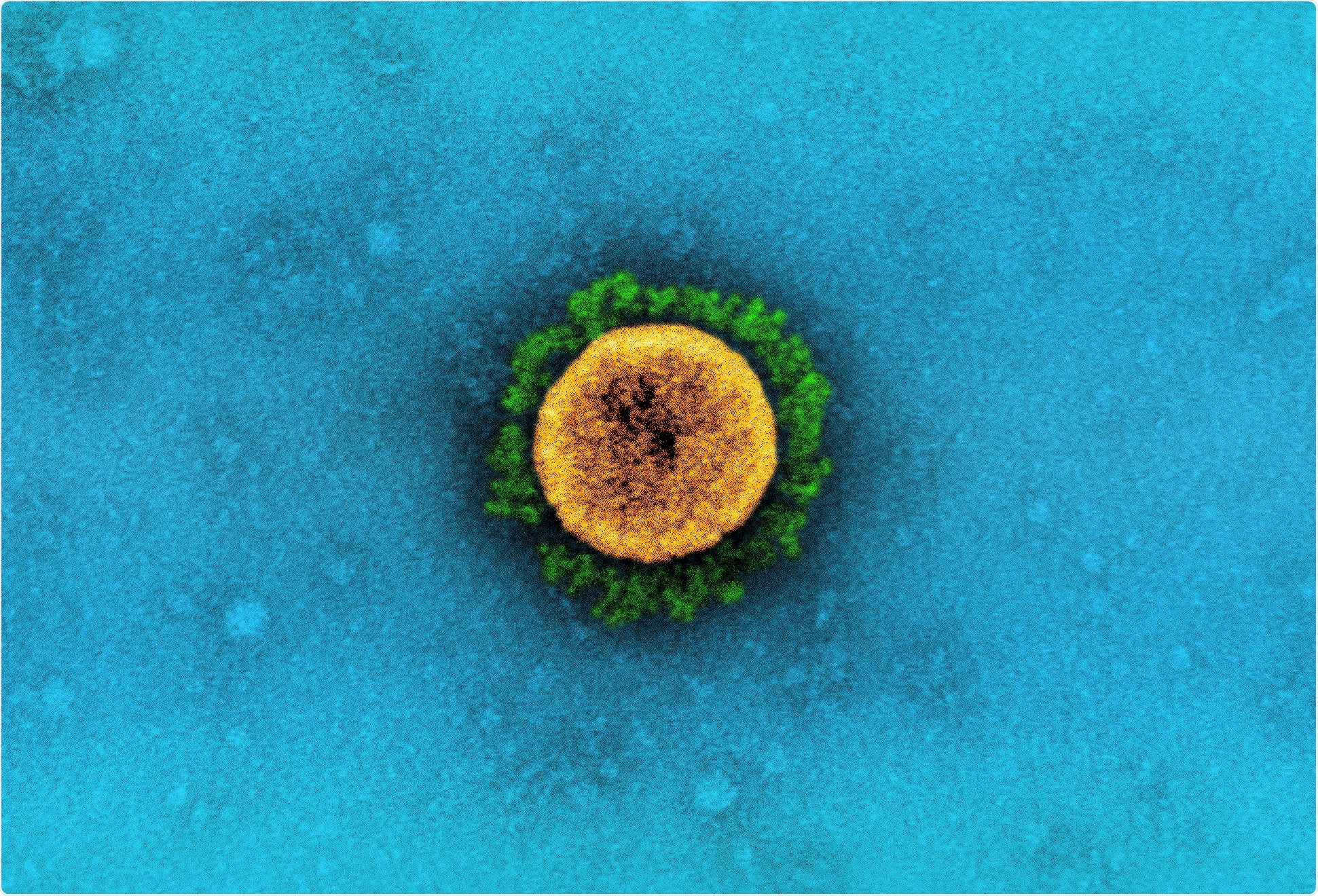 Transmission electron micrograph of a SARS-CoV-2 virus particle (UK B.1.1.7 variant), isolated from a patient sample and cultivated in cell culture. The prominent projections (green) seen on the outside of the virus particle (yellow) are spike proteins. This fringe of proteins enables the virus to attach to and infect host cells and then replicate. Image captured at the NIAID Integrated Research Facility (IRF) in Fort Detrick, Maryland. Credit: NIAID Image Credit: NIAID