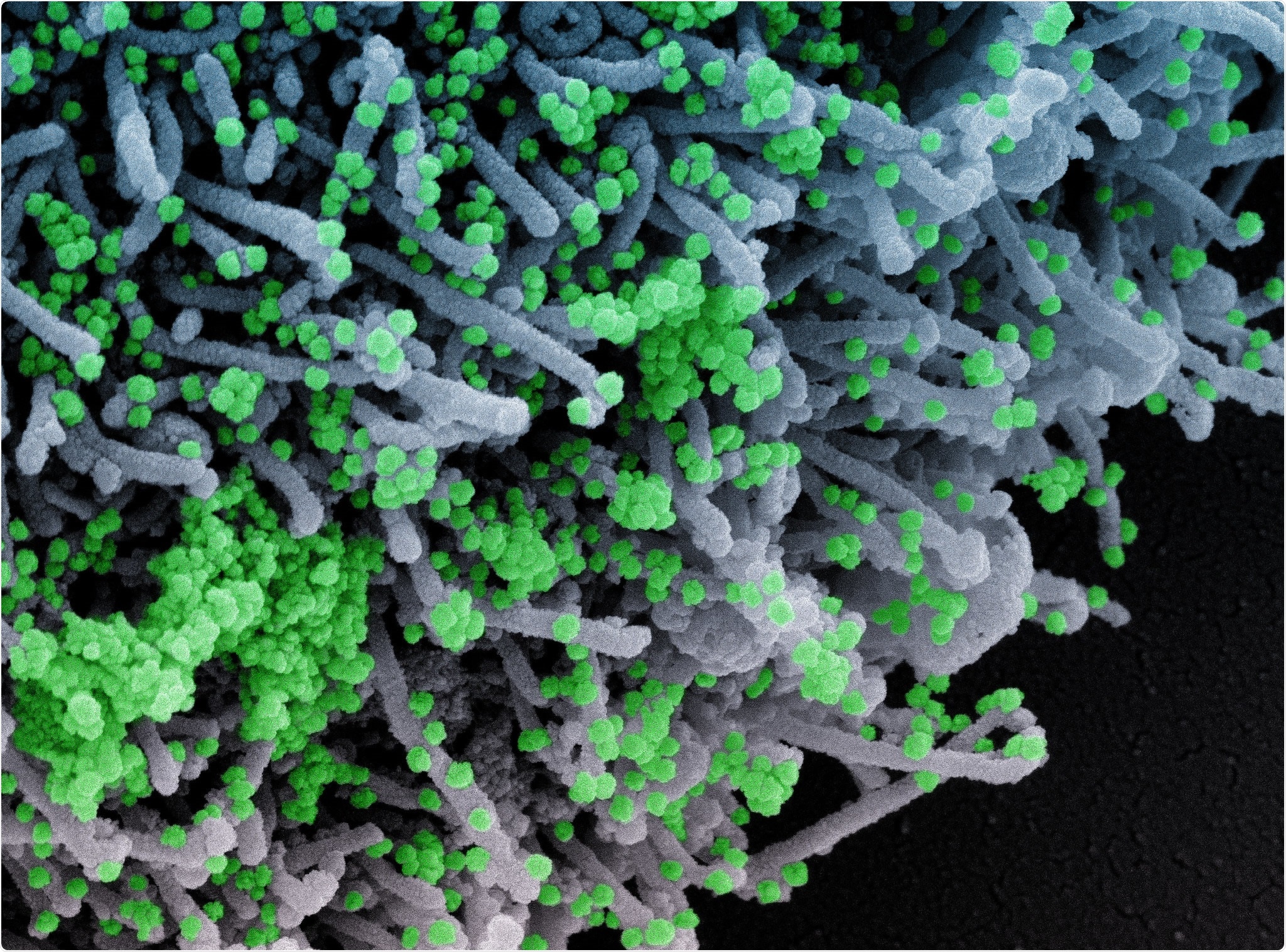 Study: Contact surveys reveal heterogeneities in age-group contributions to SARS-CoV-2 dynamics in the United States. Image Credit: NIAID