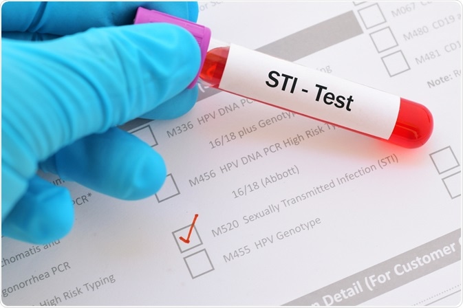 STI Test