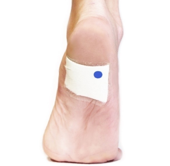 Non-invasive, tiny indicator changes color if the wound shows early signs of infection