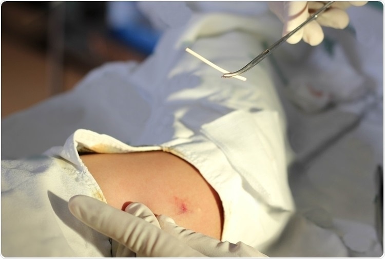 Insight into Sustained-Release Drug Delivery Systems