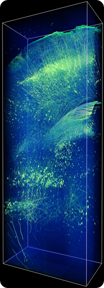 CLARITY-processed Thy1-eYFP-expressing mouse brain