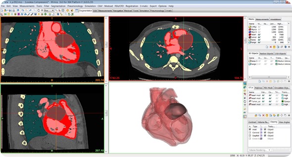 Heart scans