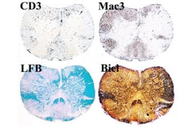 Multiple sclerosis is a very complex disease of the nervous system. Thanks to the development of the new animal model, significantly improved insights into its emergence and progress are now possible. Credit: Image: Max Planck Institute of Neurobiology