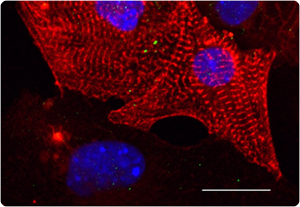 Micrograph of heart muscle cells (cardiomyocytes)