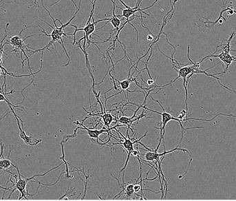 Segmentation masking of rat E18 cortical neurons
