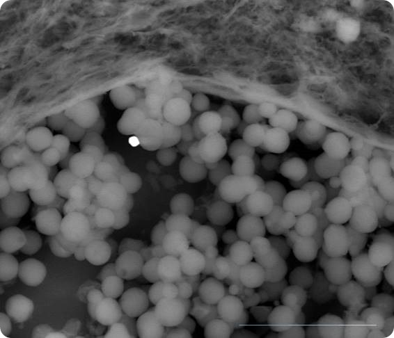 red cells metallic spherule