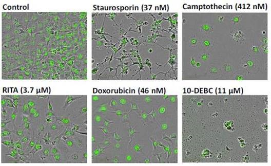 Representative ‘blended’ phase contrast/fluorescence images