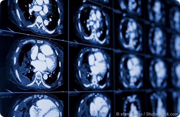 computed tomography of the chest. Medical background. monochrome photos