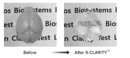 mouse brain cleared X-clarity