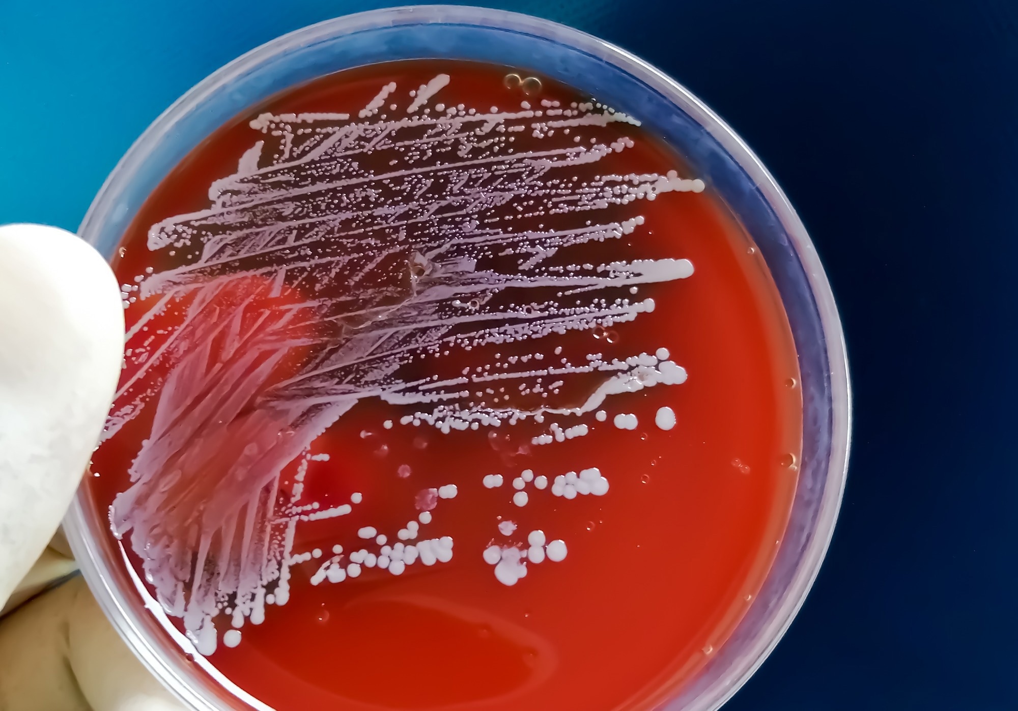 Staphylococcus aureus: Gram-positive, to Gram-variable, nonmotile, Coccus, beta hemolysis, saprotrophic bacterium that belongs to the family Staphylococcus growth on blood agar.