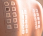 Allergy Patch Testing