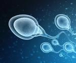 An Overview of Sperm Sorting Technologies