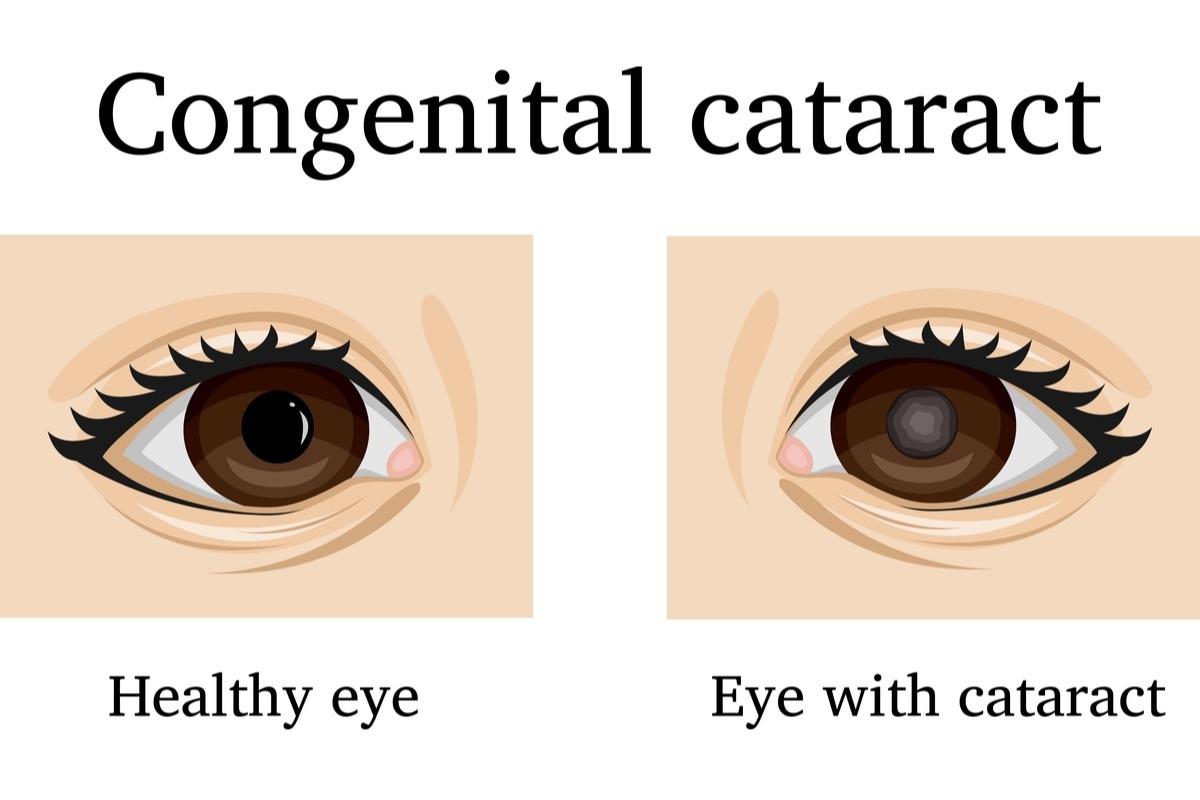 Image Credit: Scio21/Shutterstock