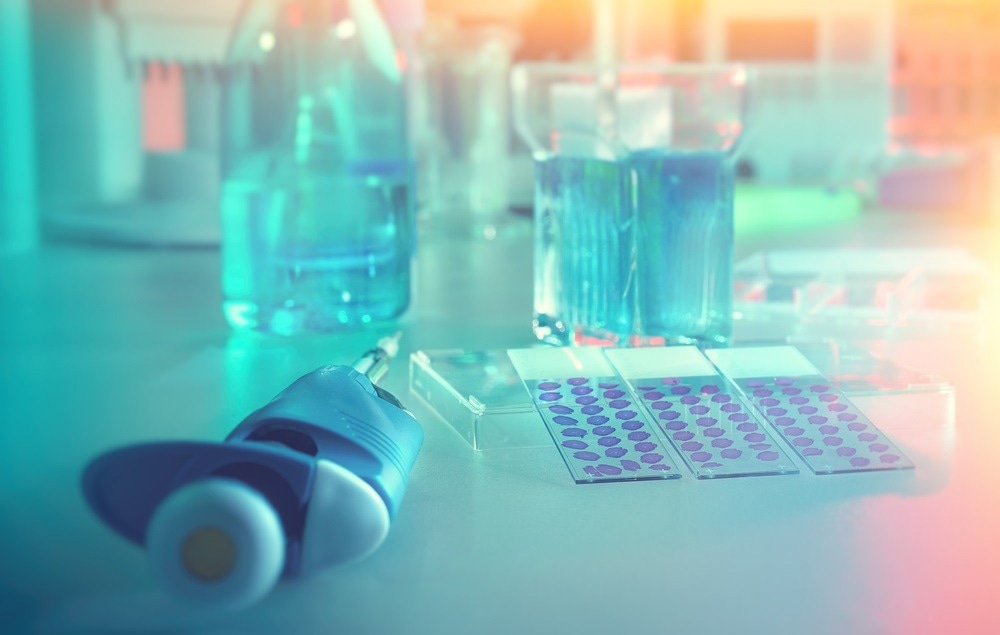 Image Credit: tilialucida/Shutterstock.com