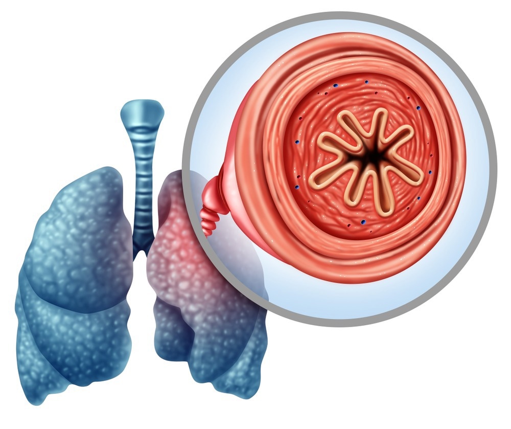 Pulmonary Disease