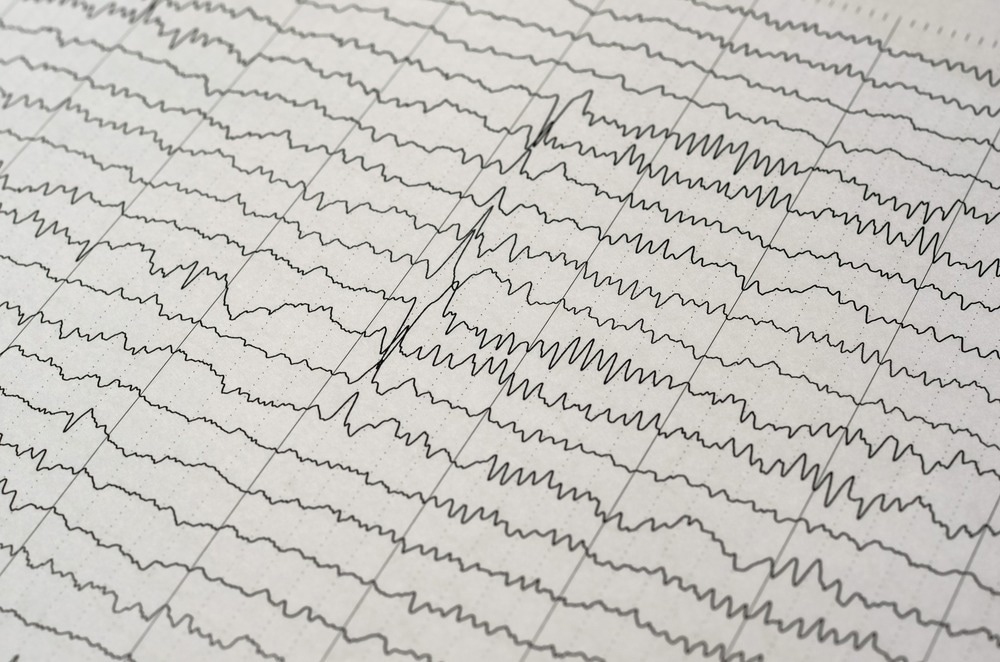 Image Credit: Chaikom/Shutterstock.com