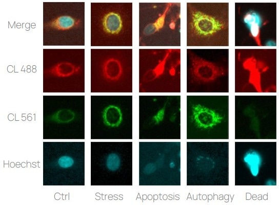 ChromaLive imaging examples. Examples of MCF-7 cells presenting various phenotypes. The experiment included 2 channels dedicated to ChromaLIVE and 1 channel dedicated to Hoechst