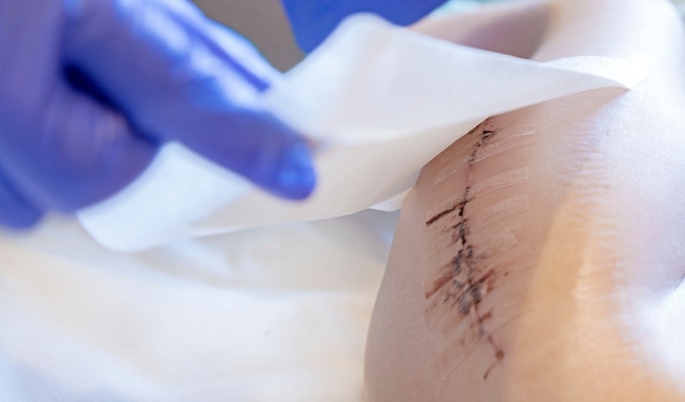 Doctor applies a patch to the scar after surgery on the child