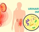 Urinary Tract Infection Symptoms