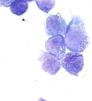 Listeria inside a macrophage, an immune cell enlisted in the immune response