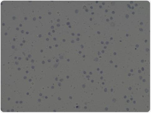 Automated image analysis of trypan blue stained cells