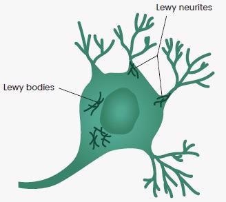 Discovering new drug targets for neurodegenerative diseases