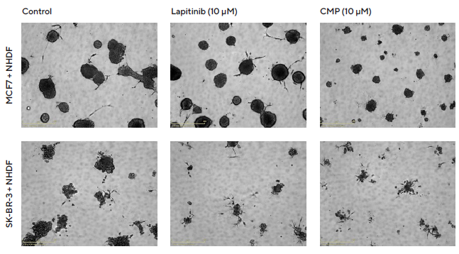 Interrogation of images to gain greater insight. MCF7 or SK-BR-3 cells co-cultured with NHDFs were seeded in pre-coated (Matrigel) flat bottom 96-well plates (1:1 ratio, 1,000 cells/well of each) and multi-spheroids allowed to form (3 d) prior to treatment with Lapatinib and Camptothecin (CMP). Incucyte® Brightfield images (5 d) show the effects of treatments on multi-spheroid size and integrity. Note: cytotoxic effects of CMP on both MCF7 and SK-BR-3 multi-spheroids and their difference in sensitivity to Lapatinib.