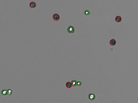 CHO cells counted with Trypan Blue. Tissue culture cells accurately counted with Trypan Blue