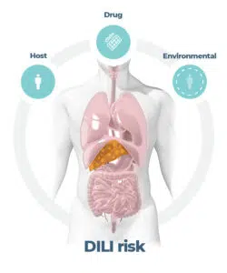 DILI is a multi-factorial pathogenesis