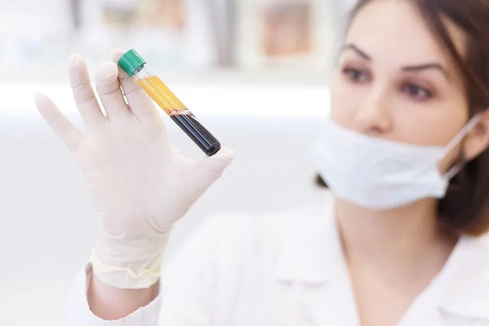 What differentiates a buffy coat from PBMCs?