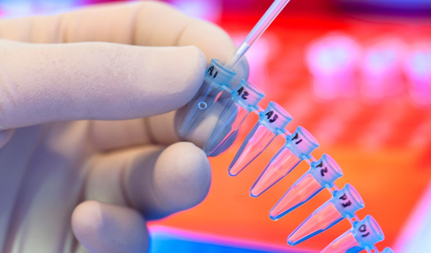 enzyme, kit making, assay