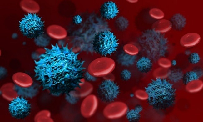 Raman spectroscopy for cancer detection