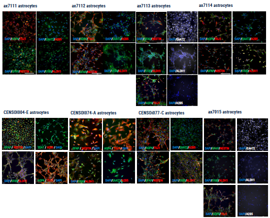 Immunocytochemistry demonstrating the expression of key astrocyte markers