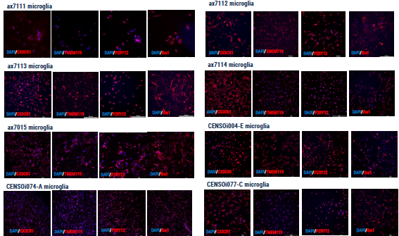 Immunocytochemistry demonstrating the expression of key microglial markers