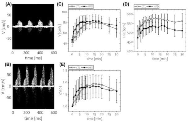 Publication 2. Short-term feeding of a high-fat diet (HFD) was not associated with impaired coronary flow reserve. Coronary flow velocity imaging was performed under two conditions: baseline and hyperemic (with regadenoson injection as a vasodilator). Time course of: C) absolute blood flow velocity, D) heart rate, and E) coronary flow reserve. *p < 0.05; n = 8 animals per group