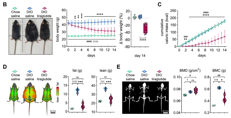 Effects of liraglutide on metabolism in type 2 diabetes and obesity