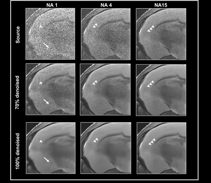 Denoising images with low tissue contrast
