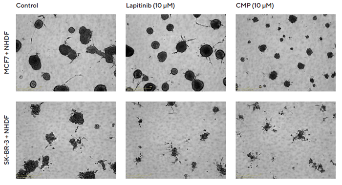 Interrogation of images to gain greater insight. MCF7 or SK-BR-3 cells co-cultured with NHDFs were seeded in pre-coated (Matrigel) flat bottom 96-well plates (1:1 ratio, 1,000 cells/well of each) and multi-spheroids allowed to form (3 d) prior to treatment with Lapatinib and Camptothecin (CMP). Incucyte® Brightfield images (5 d) show the effects of treatments on multi-spheroid size and integrity. Note: cytotoxic effects of CMP on both MCF7 and SK-BR-3 multi-spheroids and their difference in sensitivity to Lapatinib