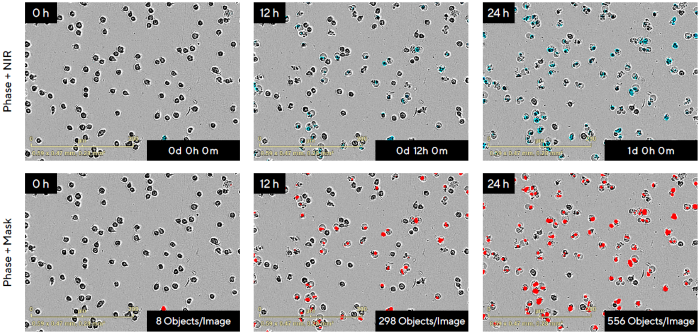 Real-Time Visualization and Quantification of Non-Adherent Jurkat Cell Death in Response to the Anti-Cancer Drug Camptothecin (CMP) Using the Incucyte<sup>®</sup> Live-Cell Analysis System
