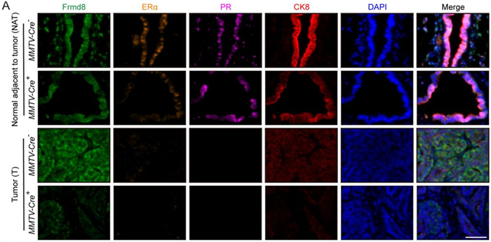 Representative multiplex immunofluorescence images of tumor tissues and tissues adjacent to tumor from MMTV-Cre-; Frmd8fl/fl; PyMT and MMTV-Cre+; Frmd8fl/fl; PyMT mice. Scale bar, 50 μm