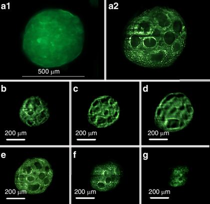 F-actin filaments in a colorectal cancer cell spheroid, captured with light sheet fluorescence microscopy. 70 images were captured through a 90-µm thick sample. b-g) Cross-sectional images taken at 15-µm intervals