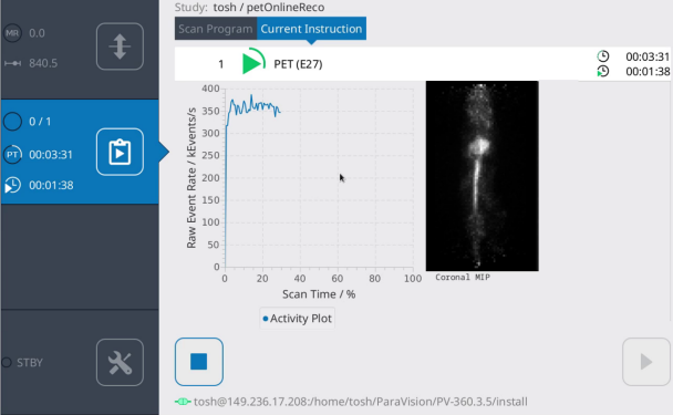 Touchscreen display of count rate evolution and MIP online reconstruction.